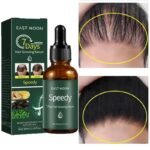 ueKkSa2669fb9194f4807b69650c89dc63e58n