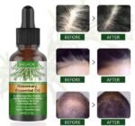 after and before EELHOE Rosemary Oil EELHOE Rosemary Essential Oil EELHOE Rosemary Oil Reviews EELHOE Rosemary Essential Oil Review eelhoerosemaryoil.com .jpg