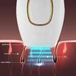 Electric IPL Hair Removal Laser Epilator Whole Body Painless Hair Remover Machine Permanent Professional Photoelectric Epilator - Image 5